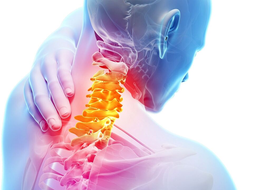 Symptômes de l'ostéochondrose cervicale